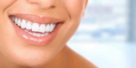 ¿Qué son Carillas dentales y cuándo son la mejor opción?