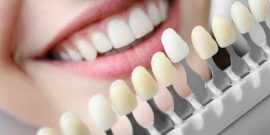 implantes-dentales-que-cuidados-necesitan Implantes dentales: ¿Qué cuidados necesitan?