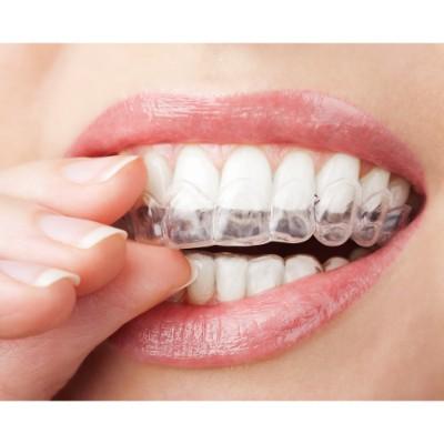 Retención, una fase esencial en el tratamiento de ortodoncia