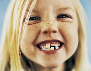 Ortodoncia Interceptiva para corregir el desarrollo oral de los niños