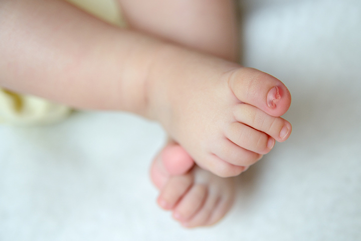 Consejos para tratar las uñas encarnadas en bebés