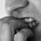 Onicofagia: Así afecta a tus dientes morderte las uñas