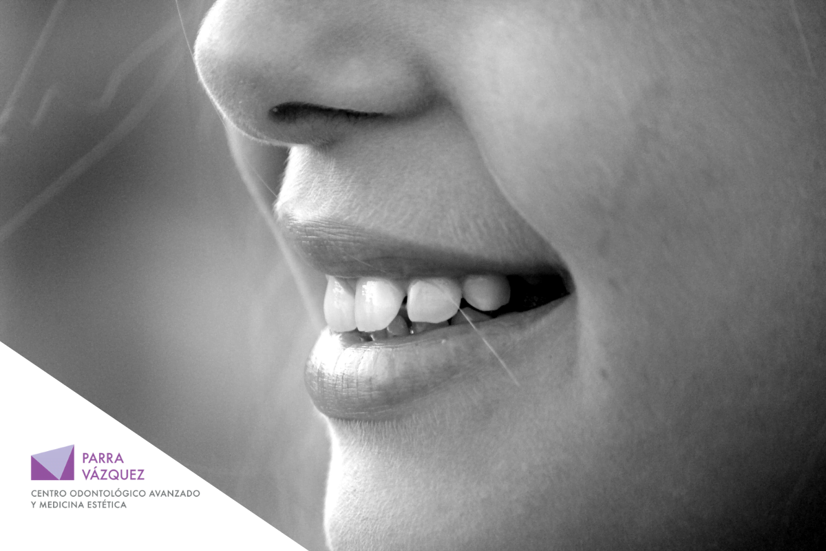 Qué es la hipoplasia dental y cómo se corrige