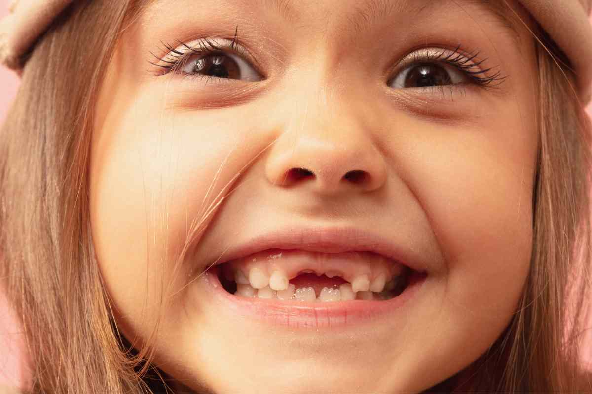 Cuándo se caen los dientes de leche