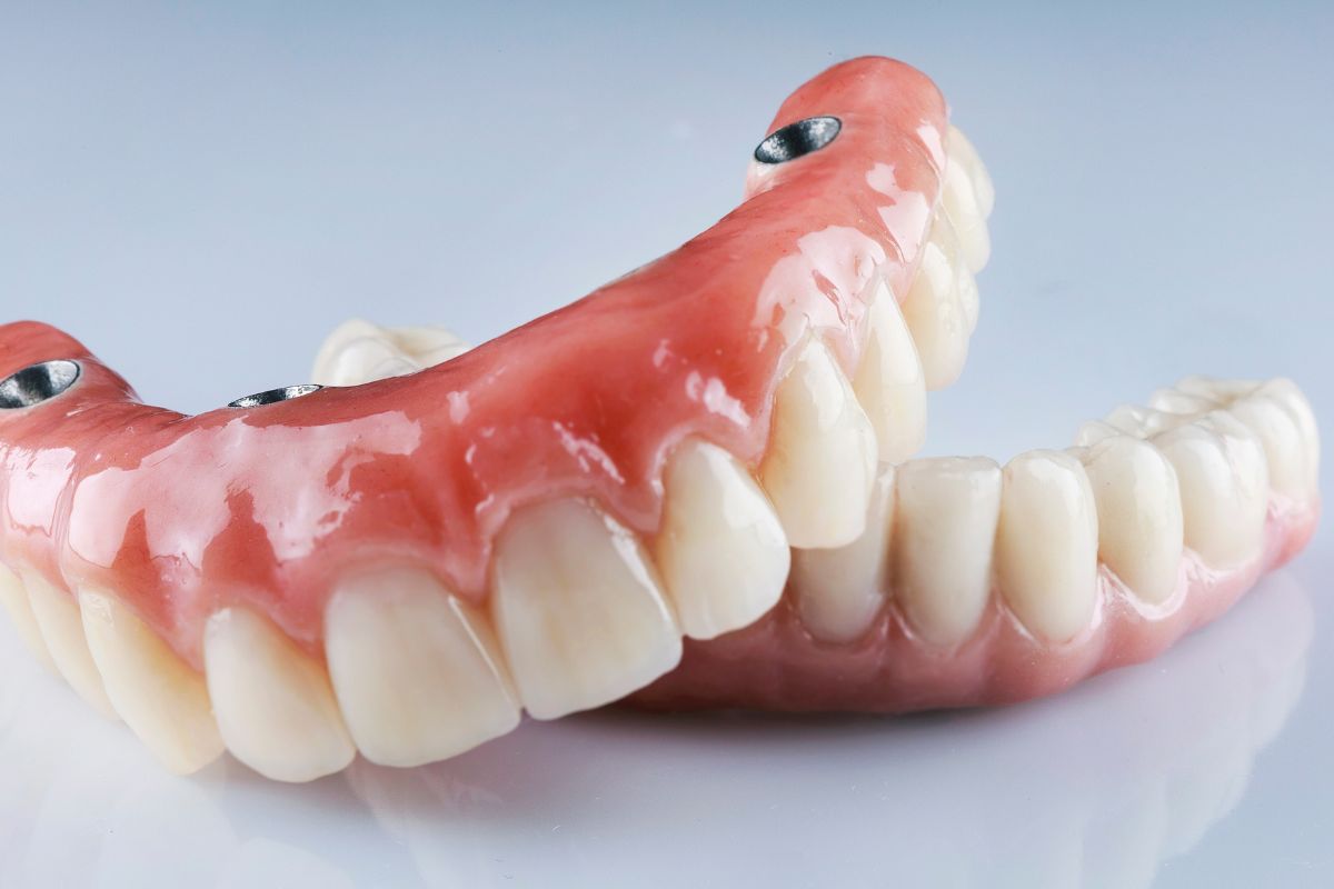 Prótesis dental de resina o porcelana, cuál es mejor