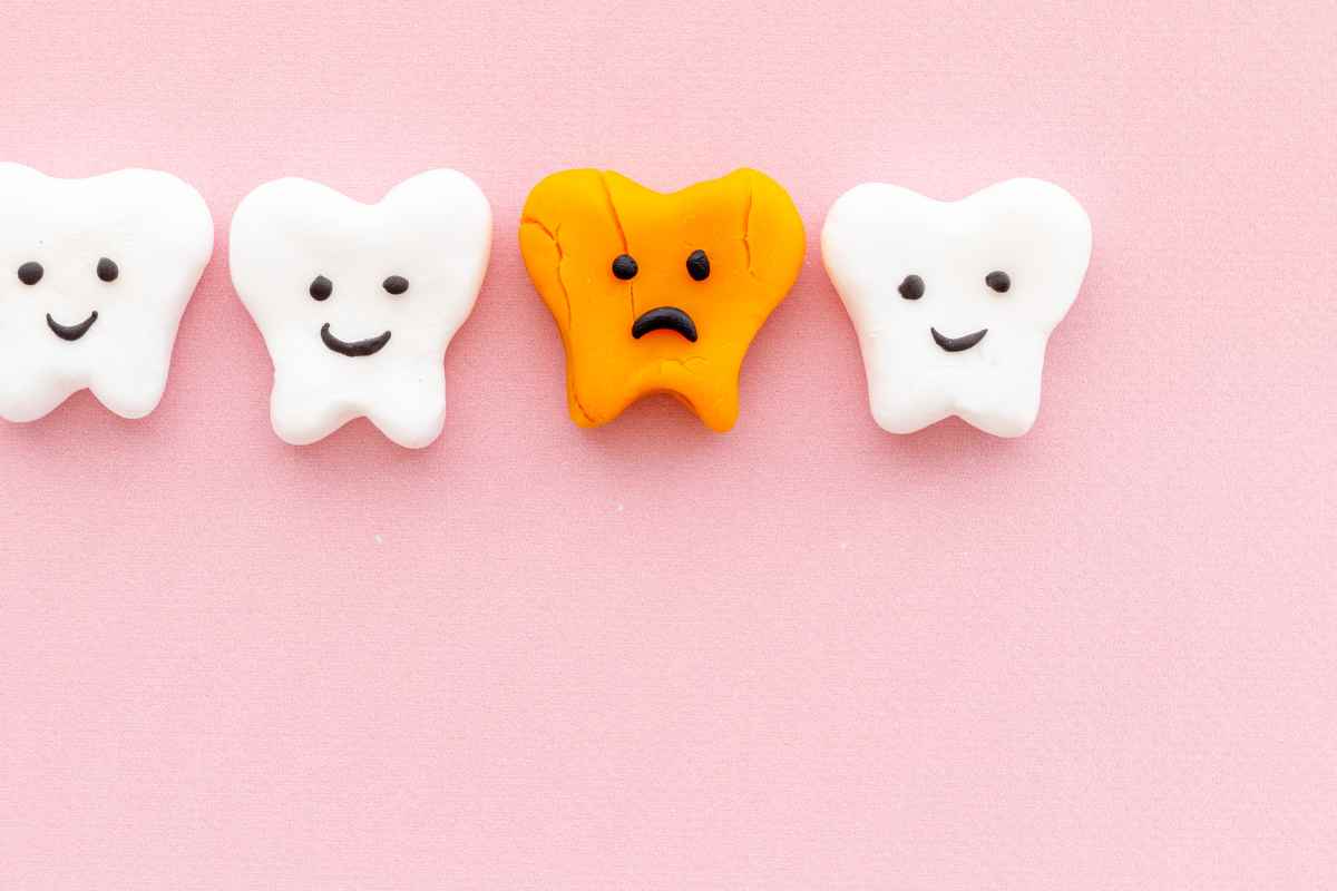 Caries interproximales, ¿qué son y en qué se diferencian de las caries más frecuentes?