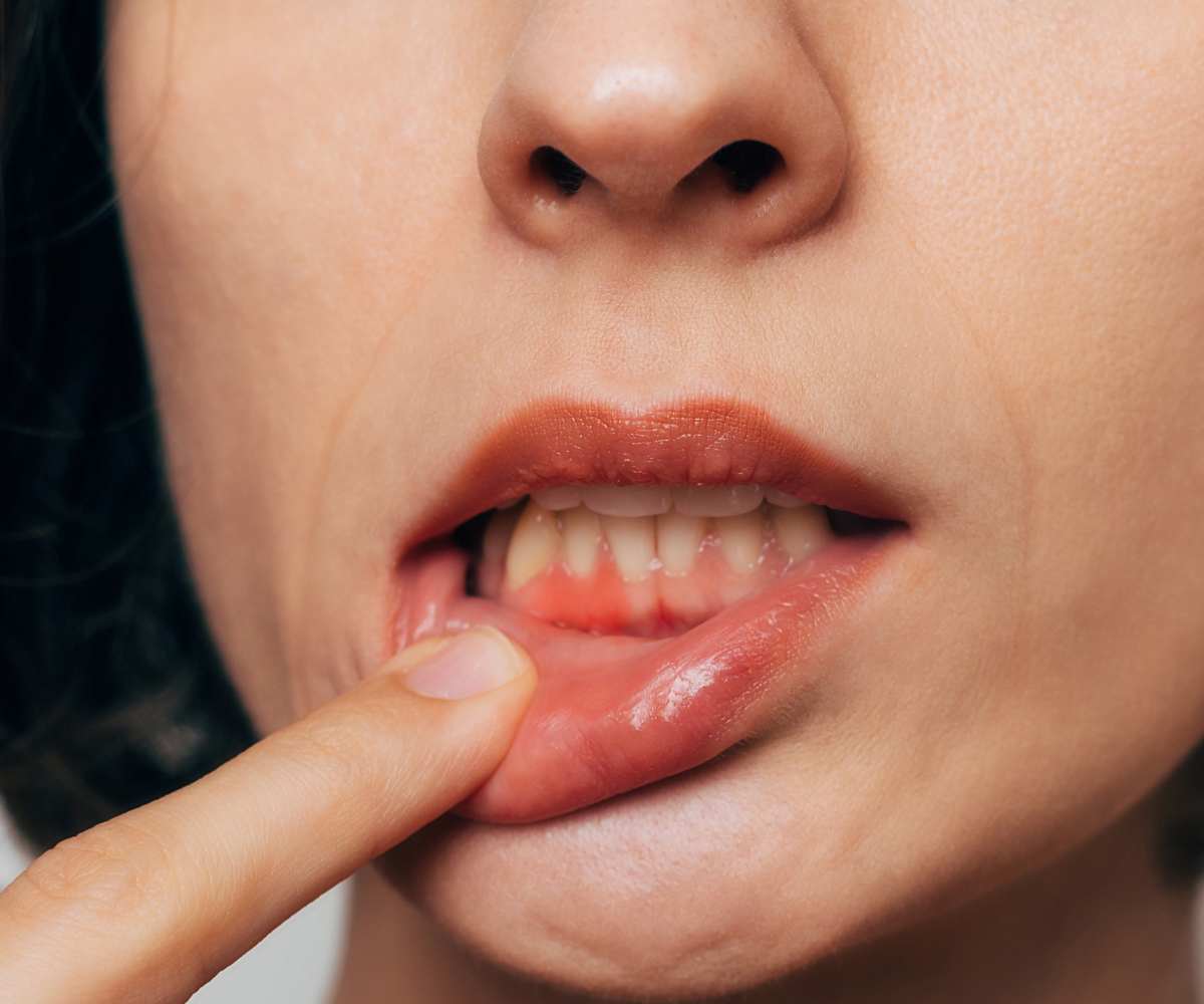 ¿Por qué me sangran las encías