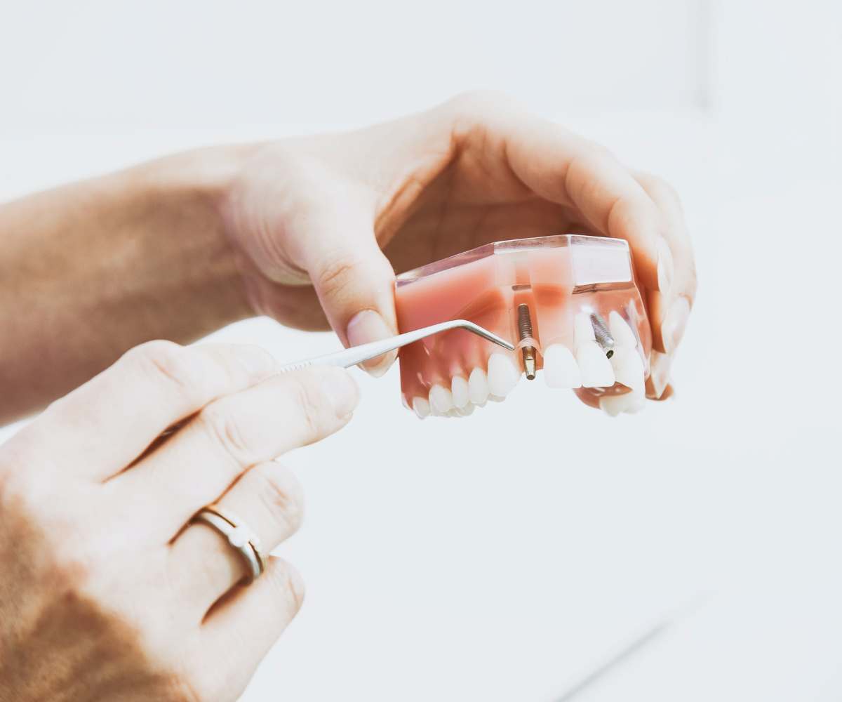 cuánto dura un implante dental